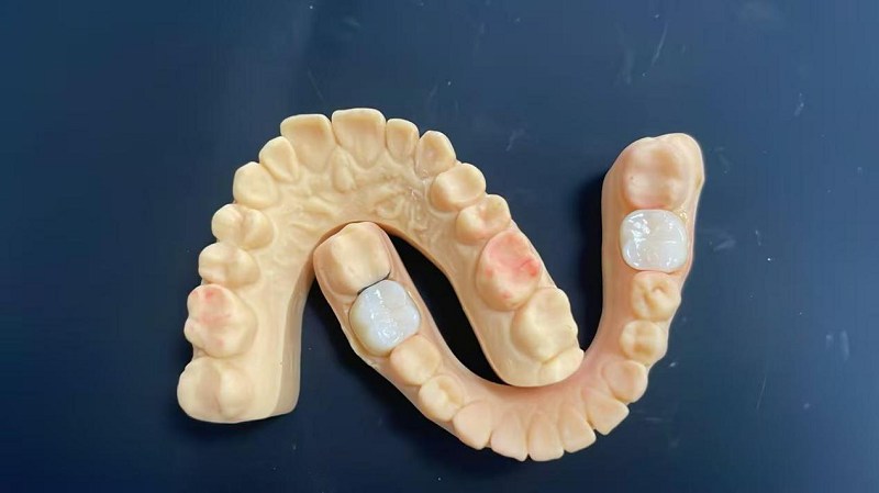 భుజం అంచు అంటే ఏమిటి?