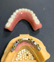 లొకేటర్ మరియు డెంటల్ బార్